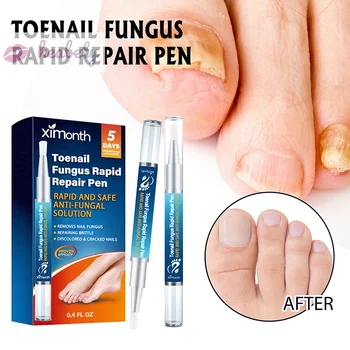 Ximonth Nail Repair Pen Repair Inlaid Nail Thickening Repair Увлажняет омертвевшую кожу, руки и седину Уход за ногтями